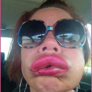 hip new fall fashion allergic reaction lips