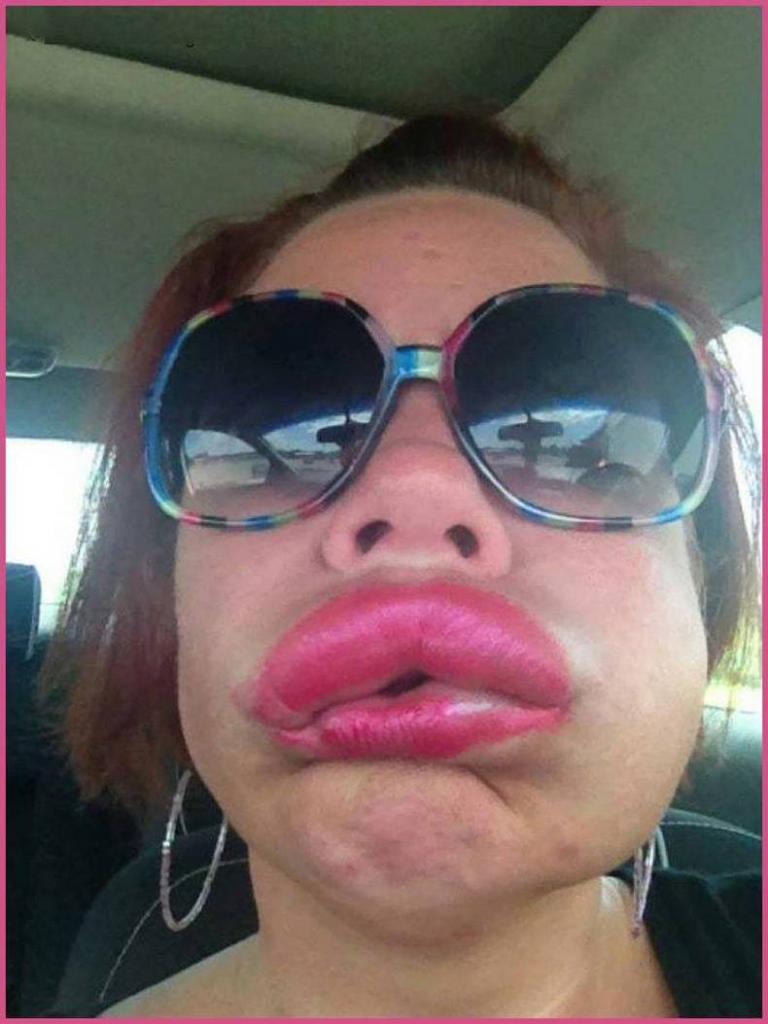 hip new fall fashion allergic reaction lips